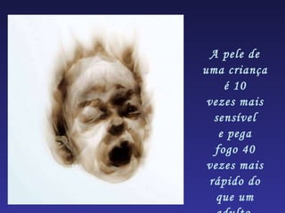 A pele de uma criança é 10 vezes mais sensível e pega fogo 40 vezes mais rápido do que um adulto. 