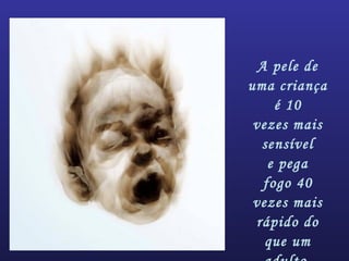 A pele de
uma criança
é 10
vezes mais
sensível
e pega
fogo 40
vezes mais
rápido do
que um
 