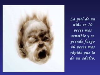 La piel de un niño es 10 veces mas sensible y se prende fuego 40 veces mas rápido que la de un adulto. 