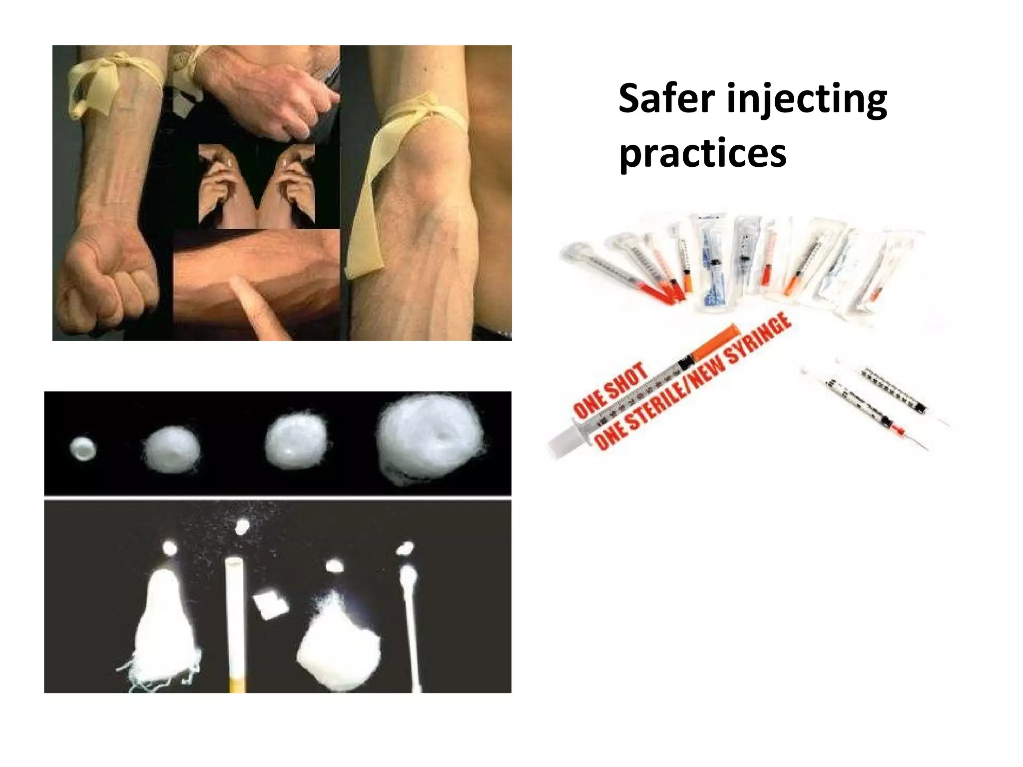 Safer injecting practices 
