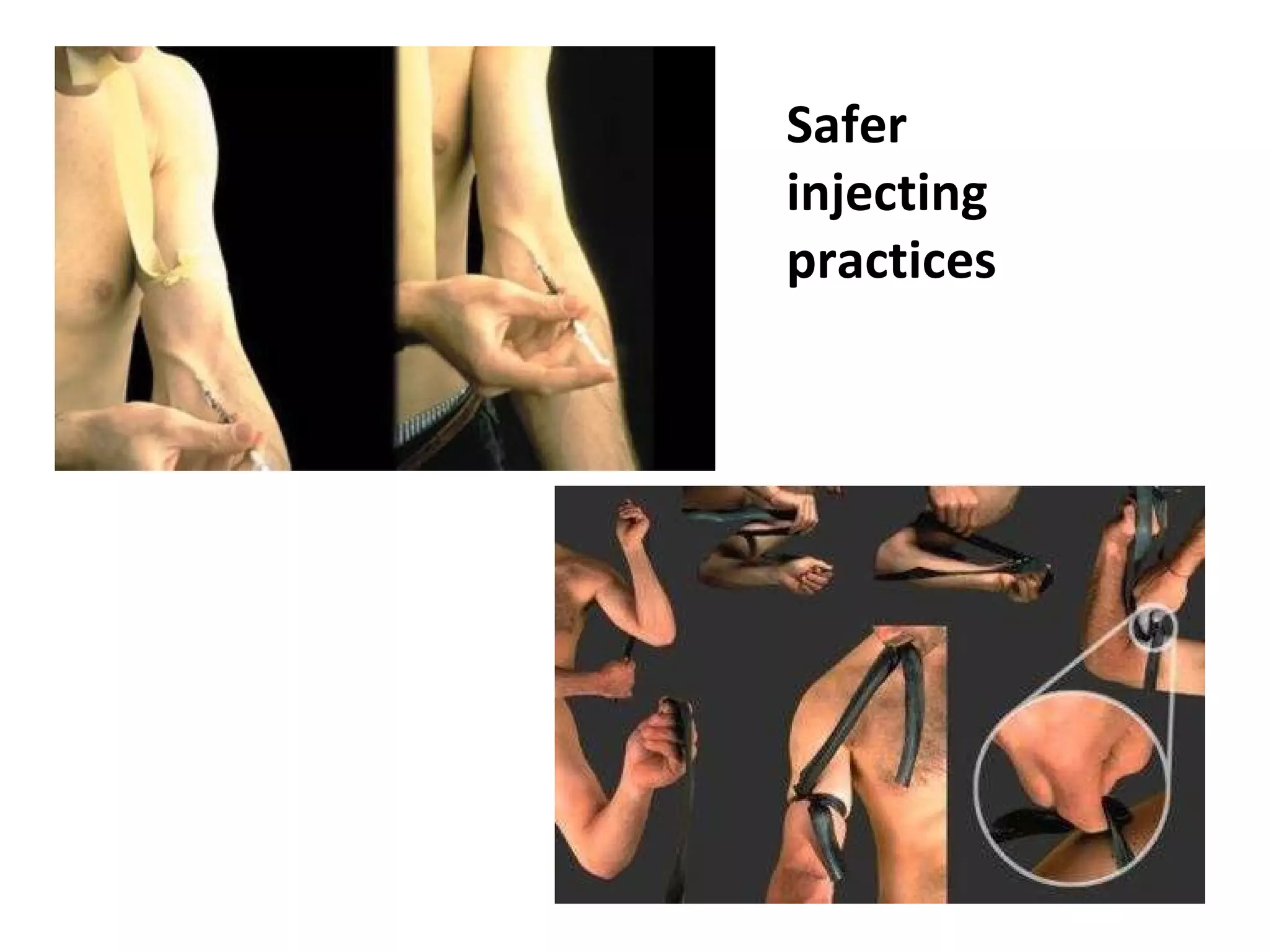 Safer injecting practices 