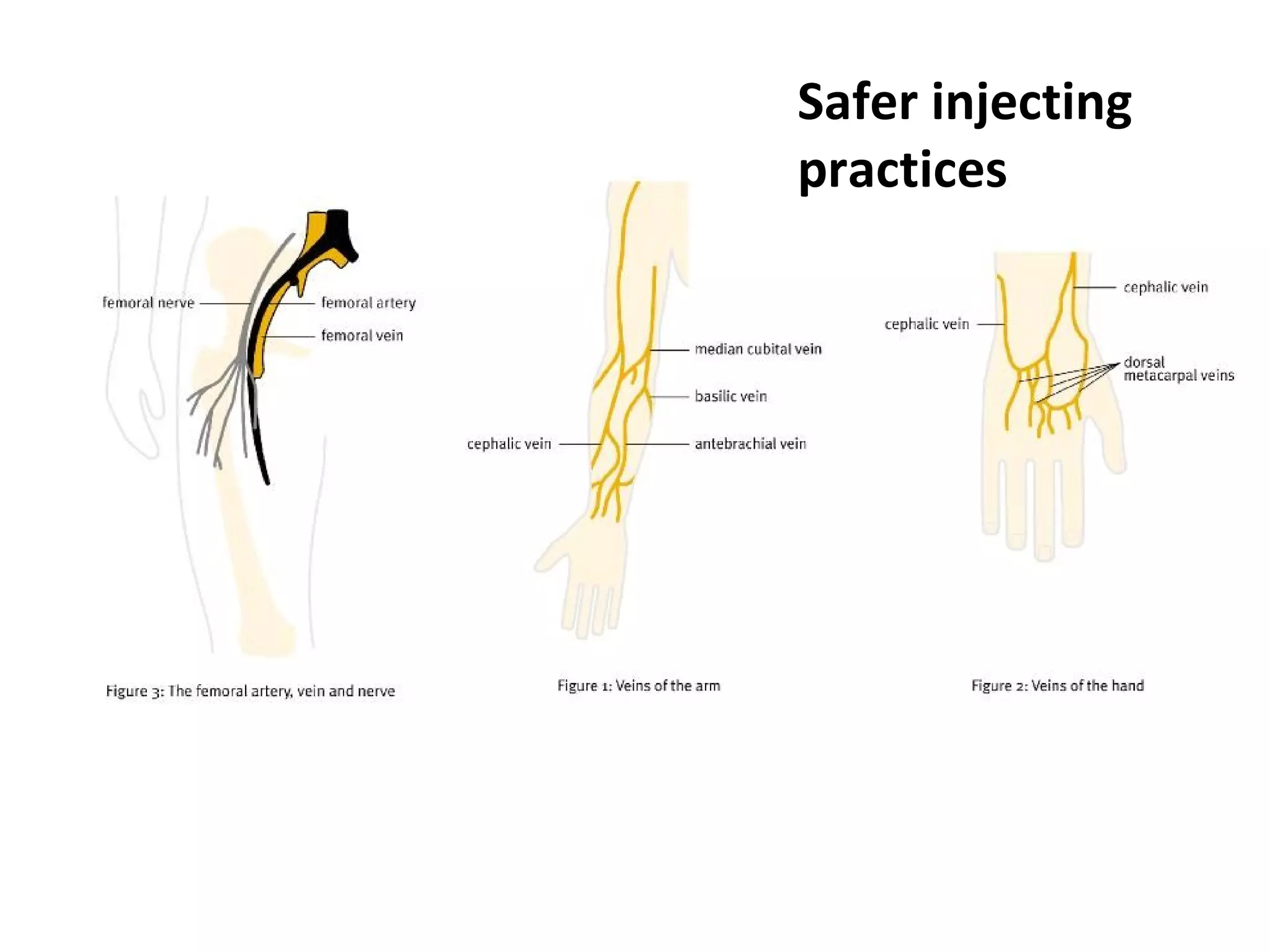 Safer injecting practices 