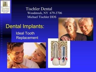 Tischler Dental 
         Woodstock, NY  679­3706 
         Michael Tischler DDS


Dental Implants: 
    Ideal Tooth 
    Replacement 
 