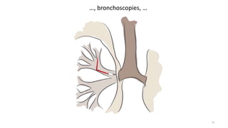 …, bronchoscopies, …
31
 