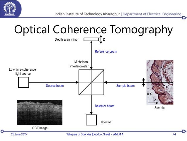 Optical coherence tomography phd thesis