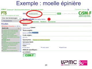 Exemple : moelle épinière




           20
 