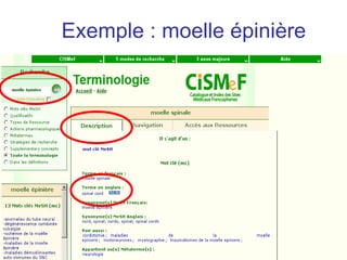 Exemple : moelle épinière
 