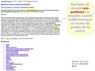 Exemple de 
résultat non-pertinent 
: la 
requête a porté 
indifféremment 
sur toutes les 
parties de la 
notice 
Source : Georges 
Beuzet, BU Santé 
Brest 
 
