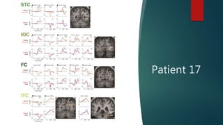 Patient 17
 