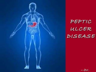 PEPTIC ULCER DISEASE --Dr. Mansi 