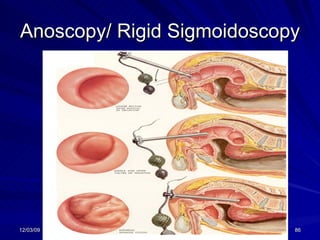 Anoscopy/ Rigid Sigmoidoscopy 