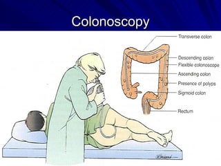 Colonoscopy 