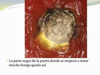  La parte negra de la punta donde se empezó a notar
mucho hongo quedo así
 