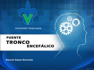 ENCEFÁLICO
Eduardo Salazar Benavides
Universidad Veracruzana
PUENTE
TRONCO
 
