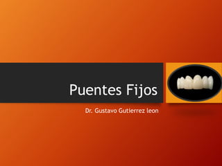 Puentes Fijos
Dr. Gustavo Gutierrez leon
 