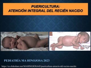 PUERICULTURA:
ATENCIÓN INTEGRAL DEL RECIÉN NACIDO
PEDIATRÍA MA HINOJOSA 2023
https://es.slideshare.net/MAHINOJOSA45/puericultura-atencin-del-recien-nacido
 