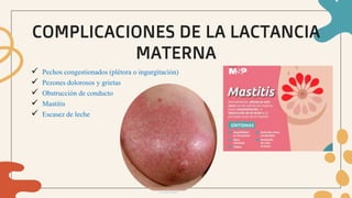 COMPLICACIONES DE LA LACTANCIA
MATERNA
 Pechos congestionados (plétora o ingurgitación)
 Pezones dolorosos y grietas
 Obstrucción de conducto
 Mastitis
 Escasez de leche
 