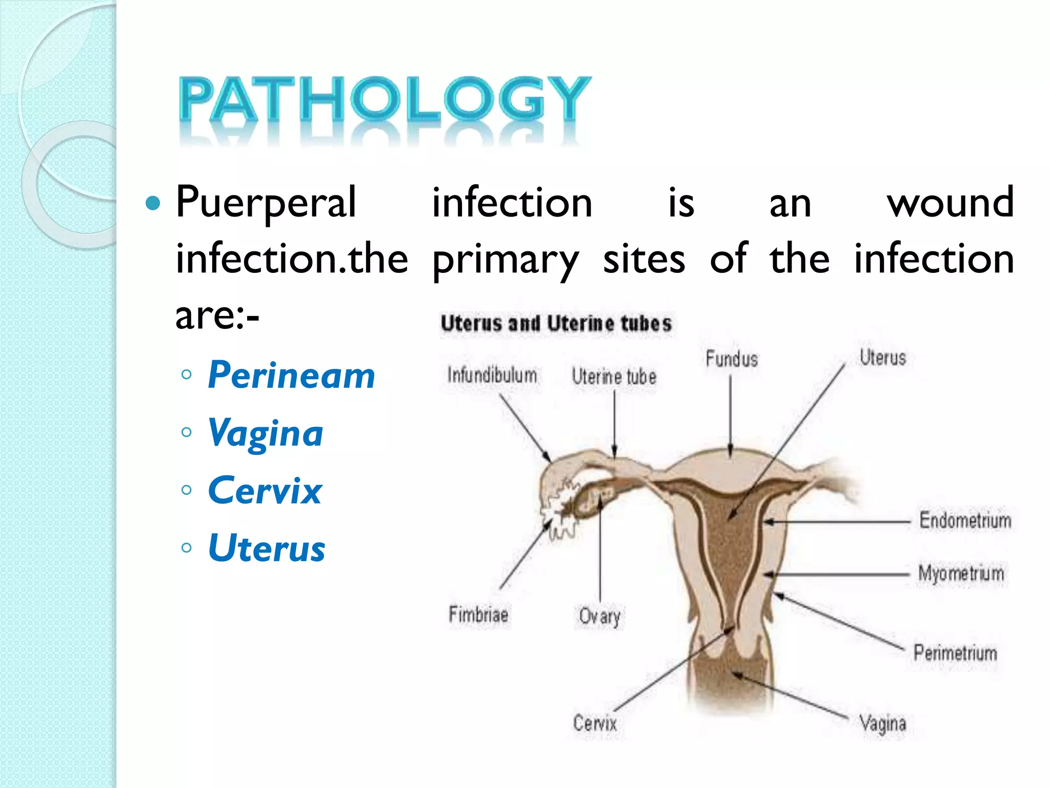 Puerperal sepsis | PPTX