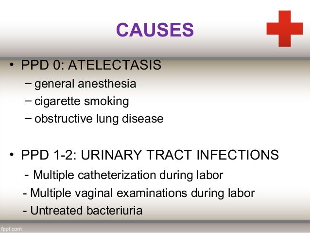 Puerperal sepsis