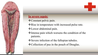 In severe sepsis:
Constant pelvic pain.
Rise in temperature with increased pulse rate.
Lower abdominal pain.
Intense pain which worsens the condition of the
patients.
Severe infection of the fallopian tubules.
Collection of pus in the pouch of Douglas.
 