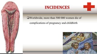 INCIDENCES
Worldwide, more than 500 000 women die of
complications of pregnancy and childbirth
 