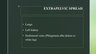 z
EXTRAPELVIC SPREAD
 Lungs
 Left kidney
 Iliofemoral veins (Phlegmasia alba dolens or
white leg)
 