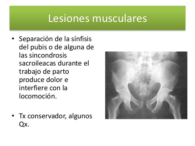 Las rayas de las ojeras