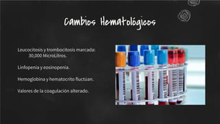 Leucocitosis y trombocitosis marcada:
30,000 MicroLitros.
Linfopenia y eosinopenia.
Hemoglobina y hematocrito ﬂuctúan.
Valores de la coagulación alterado.
Cambios Hematológicos
 