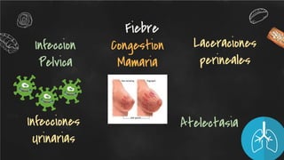 Infeccion
Pelvica
Congestion
Mamaria
Laceraciones
perineales
Fiebre
Infecciones
Urinarias
Atelectasia
 