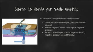 La técnica se conoce de forma variable como:
● Cierre por vacío asistido (VAC, vacuum-assisted
closure)
● Presión negativa tópica (TNP, topical negative
pressure)
● Terapia de herida por presión negativa (NPWT,
negative-pressure wound therapy)
Cierre de Herida por Vacío asistido
 