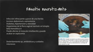 - Infección infrecuente y grave de una herida
- Incision abdominal o episiotomia
- Diabetes, hipertensión y obesidad
- Organismos de la ﬂora vaginal normal o el strepto
beta hemolítico A
- Puede afectar el músculo (miofascitis y puede
acabar en septicemia
- Desbridamiento qx, antibióticos y cuidados
intensivos
Fascitis necrotizante
 