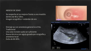 ABSESO DE SENO
- Se sospecha al no mejorar frente a una mastitis
dentro de 48 a 72hrs
- Imagen ecográﬁca = estándar de oro
- Drenaje qx con anestesia general es el tto.
Tradicional
- Una sola incisión suele ser suﬁciente
- Nueva técnica con aguja guiada por ecografía y
anestesia local
- Exito de 80-90%
 