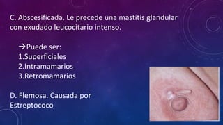 C. Abscesificada. Le precede una mastitis glandular
con exudado leucocitario intenso.
Puede ser:
1.Superficiales
2.Intramamarios
3.Retromamarios
D. Flemosa. Causada por
Estreptococo
 