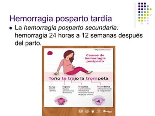 Hemorragia posparto tardía
 La hemorragia posparto secundaria:
hemorragia 24 horas a 12 semanas después
del parto.
 