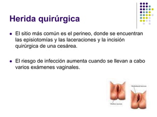 Herida quirúrgica
 El sitio más común es el perineo, donde se encuentran
las episiotomías y las laceraciones y la incisión
quirúrgica de una cesárea.
 El riesgo de infección aumenta cuando se llevan a cabo
varios exámenes vaginales.
 