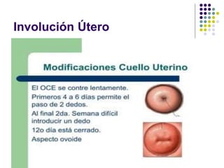 Involución Útero
 