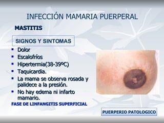 MASTITIS Dolor Escalofríos Hipertermia(38-39ºC) Taquicardia. La mama se observa rosada y palidece a la presión. No hay edema ni infarto mamario. FASE DE LINFANGITIS SUPERFICIAL INFECCIÓN MAMARIA PUERPERAL SIGNOS Y SINTOMAS PUERPERIO PATOLOGICO 