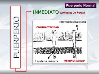 PUERPERIO INMEDIATO  (primeras 24 horas) Puerperio Normal RETRACTILIDAD CONTRACTILIDAD 