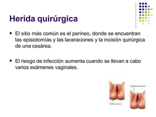 Herida quirúrgica
 El sitio más común es el perineo, donde se encuentran
las episiotomías y las laceraciones y la incisión quirúrgica
de una cesárea.
 El riesgo de infección aumenta cuando se llevan a cabo
varios exámenes vaginales.
 
