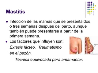 Mastitis
 Infección de las mamas que se presenta dos
o tres semanas después del parto, aunque
también puede presentarse a partir de la
primera semana.
 Los factores que influyen son:
Éxtasis lácteo. Traumatismo
en el pezón.
Técnica equivocada para amamantar.
 