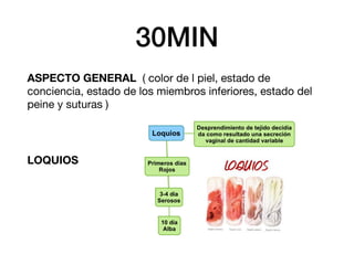 30MIN
ASPECTO GENERAL ( color de l piel, estado de
conciencia, estado de los miembros inferiores, estado del
peine y suturas )
LOQUIOS
 