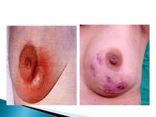 F. Gary Cunninghan, Kenneth J. Leveno
et. al. "obstetricia Williams" 22a edición.
ed. Mac Graw Hill
 