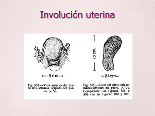 Involución uterina
