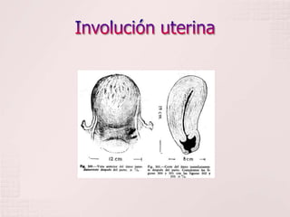 Involución uterina