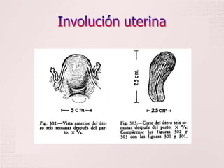 Involución uterina<br />