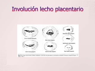 Involución lecho placentario<br />