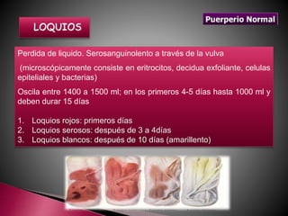 Puerperio normal | PPT