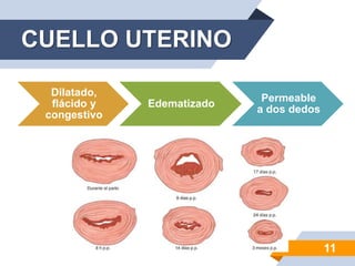 CUELLO UTERINO
11
Dilatado,
flácido y
congestivo
Edematizado
Permeable
a dos dedos
 