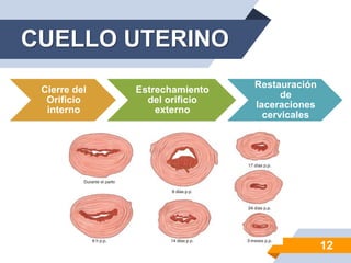 CUELLO UTERINO
12
Cierre del
Orificio
interno
Estrechamiento
del orificio
externo
Restauración
de
laceraciones
cervicales
 