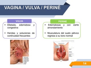 VAGINA / VULVA / PERINÉ
14
 Edematosas y con cierto
amorotamiento
 Musculatura del suelo pélvico
regresa a su tono normal
 Dilatada, edematosa y
congestiva
 Heridas y soluciones de
continuidad frecuentes
VULVA PERINE
 